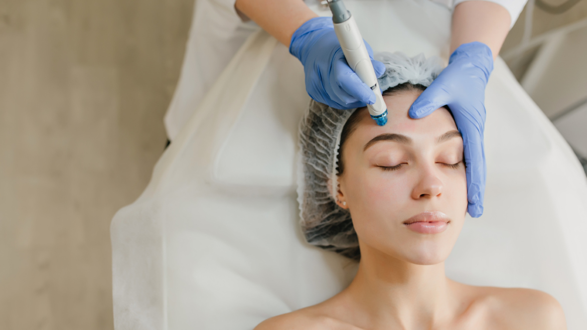 Microneedling mit Dermapen 4™