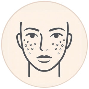 Unreine-Haut-&-große-Poren