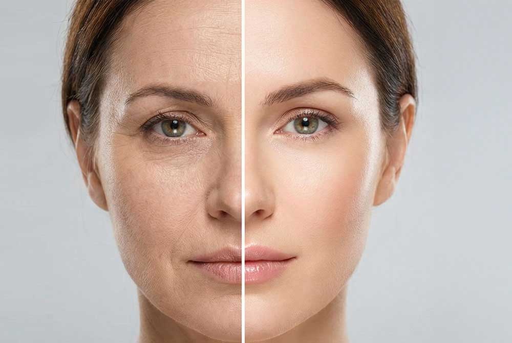 Anti-aging-Behandlung