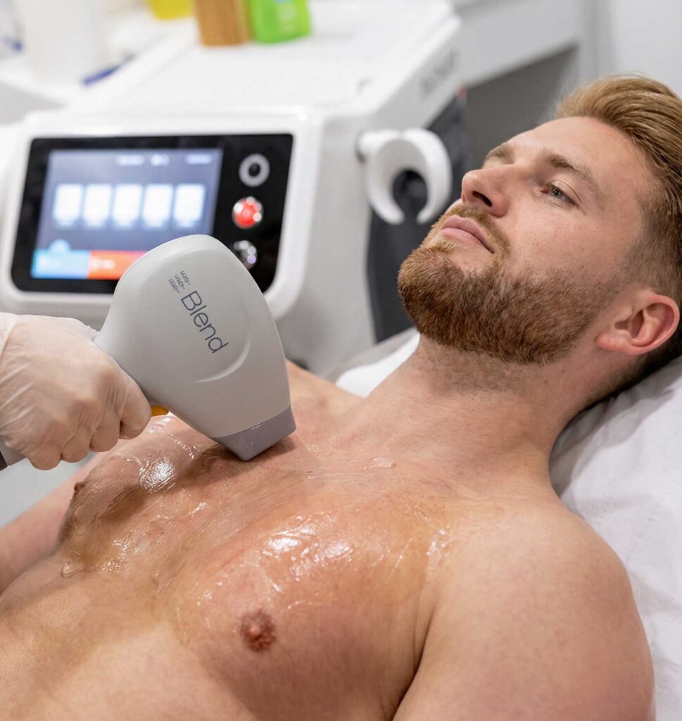 Laser Haarentfernung für Männer in München