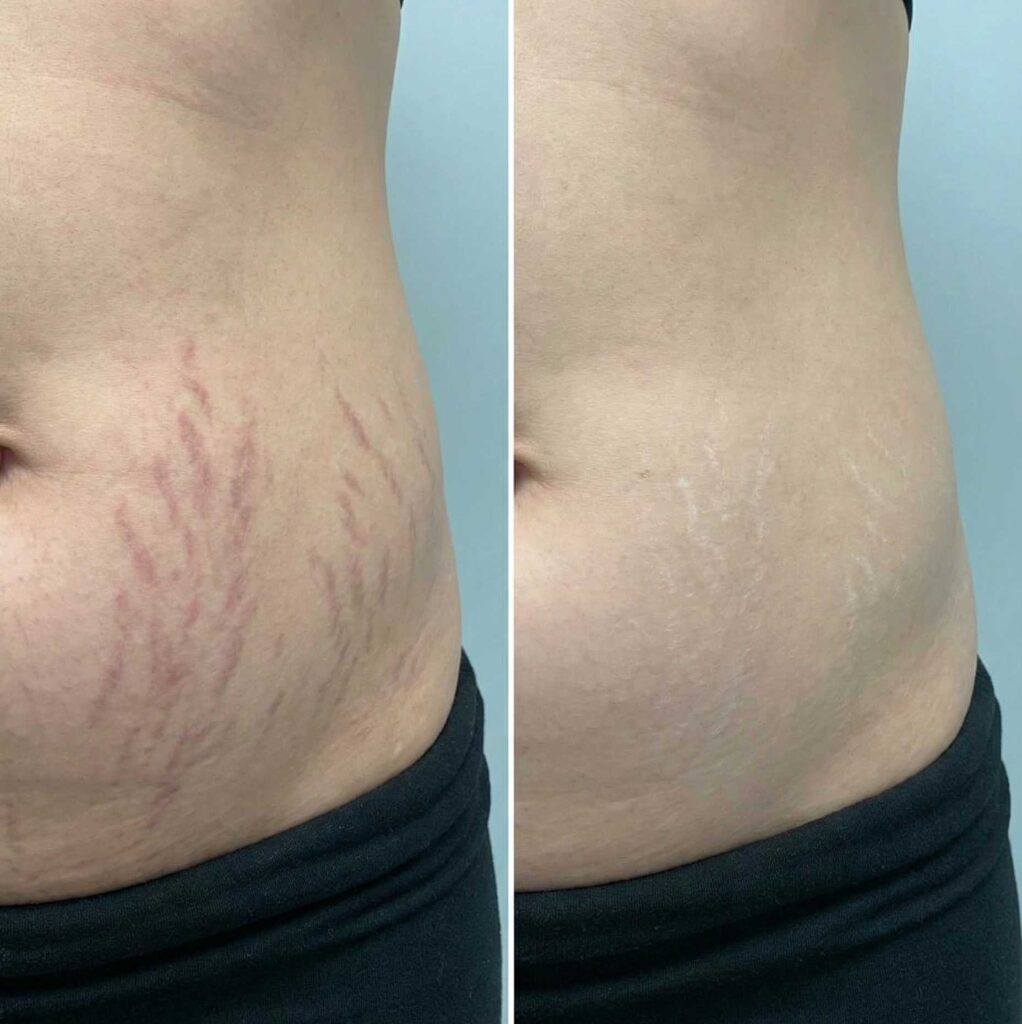 Warum Sie für die Behandlung zu uns ins Kosmetikstudio kommen sollten