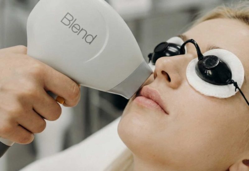 Dauerhafte Haarentfernung Gesicht München