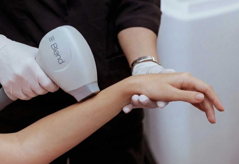 Haarentfernung an Beinen und Armen München