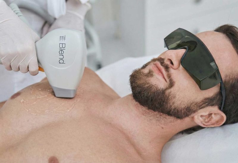 Haarentfernung brust & bauch München